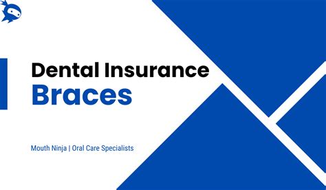 Best Dental Insurance For Braces Coverage Cost Comparison In 2024 Best Dental Insurance For Braces Coverage Cost Comparison In 2024