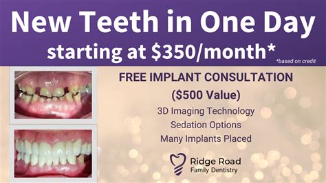 Best Insurance For Dental Implants Best Insurance For Dental Implants