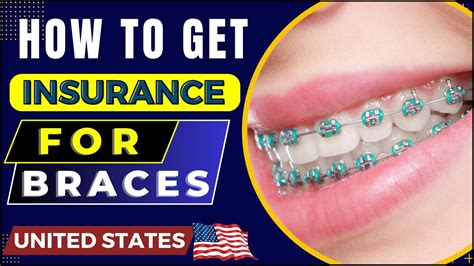 Braces Dental Coverage At Travis Daughtry Blog Braces Dental Coverage At Travis Daughtry Blog