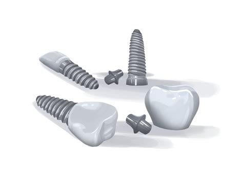 Cheap Dentist Without Insurance In Akron Oh Cheap Dentist Near Me