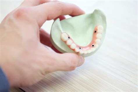 Dental Insurance That Covers Crowns