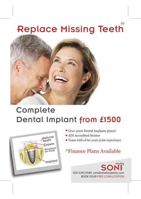 Dental Insurance Uk Covers Implants All Insurances Dental Insurance Uk Covers Implants All Insurances