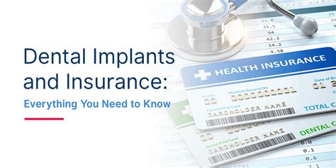 Does Dental Insurance Cover Implants All You Need To Know Does Dental Insurance Cover Implants All You Need To Know