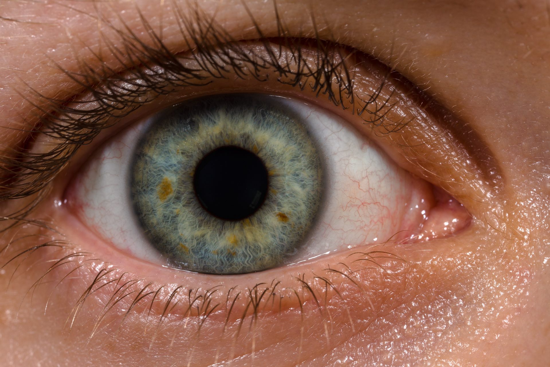 Eye Doctor Without Insurance