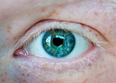 Eye Exam Without Insurance Grants For Medical Eye Exam Without Insurance Grants For Medical