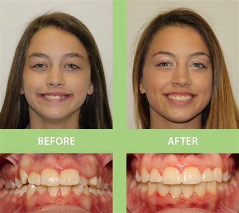 Insuring Smiles