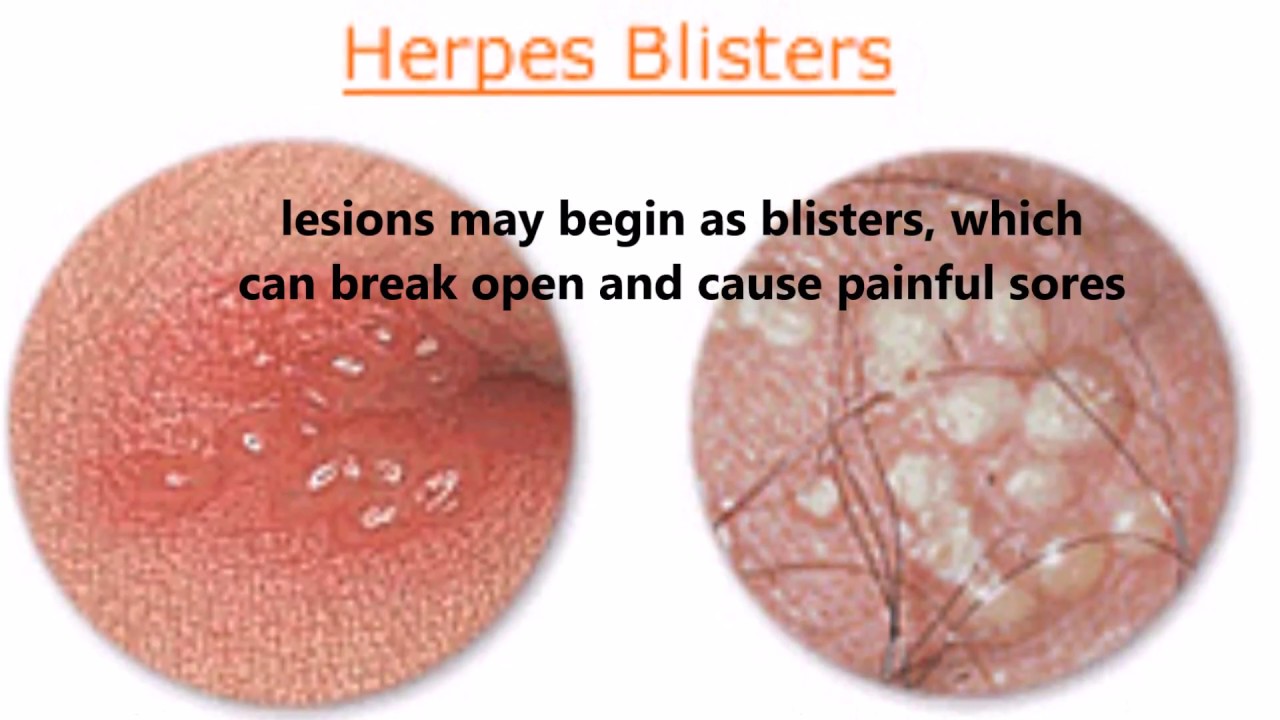 Std Testing With Insurance Std Testing Near Me Std Testing With Insurance Std Testing Near Me