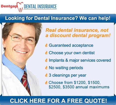 Tips To Purchase Dental Insurance No Waiting Period Plan Dental Tips To Purchase Dental Insurance No Waiting Period Plan Dental