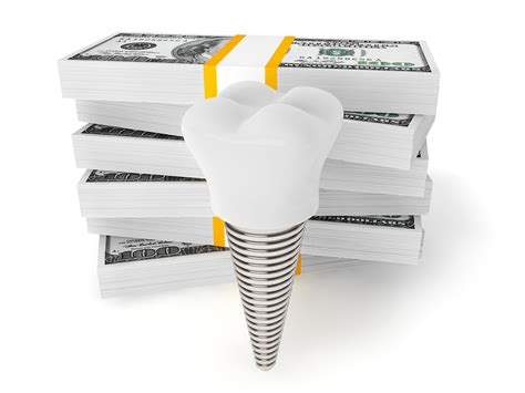 What If My Dental Insurance Doesn T Cover Dental Implants Roy Dental