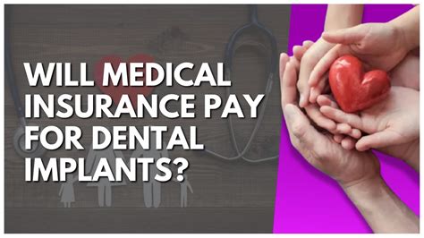 Will Medical Insurance Pay For Dental Implants Youtube Will Medical Insurance Pay For Dental Implants Youtube
